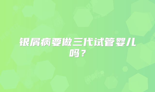 银屑病要做三代试管婴儿吗?